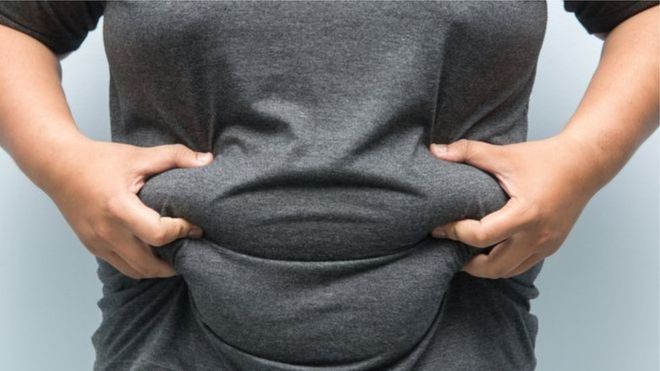 Obésité en Algérie: 50% des hommes et un tiers des femmes souffrent de surpoids