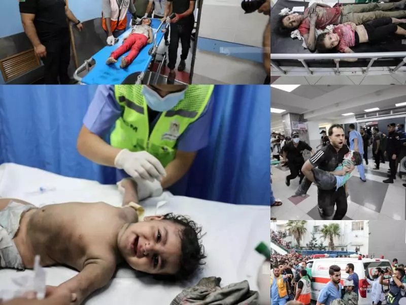 الجزائر تعلن استقبال 400 طفل فلسطيني مصاب لتلقي العلاج
